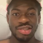 Lil Nas X reveals one side of his face is paralyzed