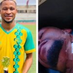 Plateau United claims that the player’s bloody attack in Nasarawa was prearranged.