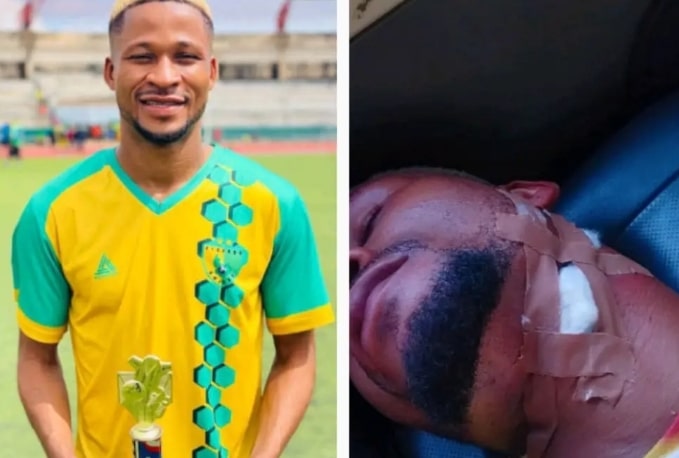 Plateau United claims that the player’s bloody attack in Nasarawa was prearranged.