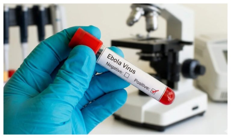 Health: A medical expert claims that Ebola can be confused with malaria.